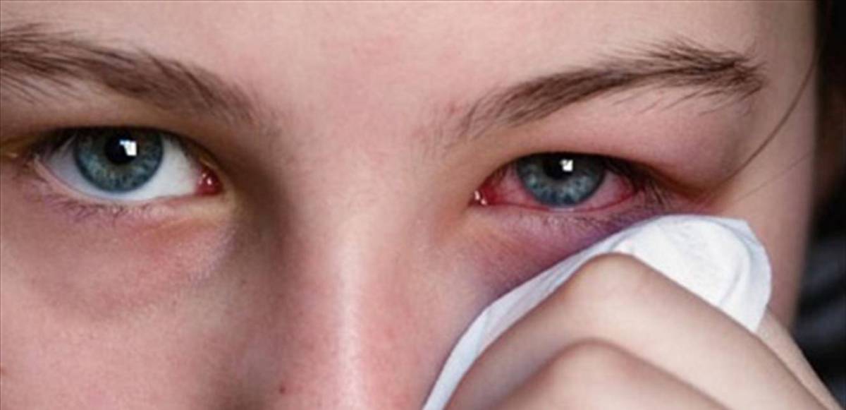 التهاب العيون وطرق الوقاية | Addiyar